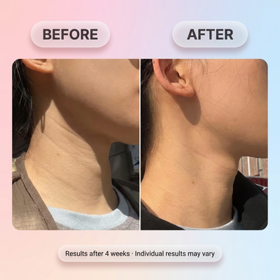 Bio-Collagen Neck Patch