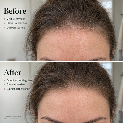 Korean Scalp Reset Bar